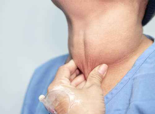 Goiter Treatment in Ayurveda