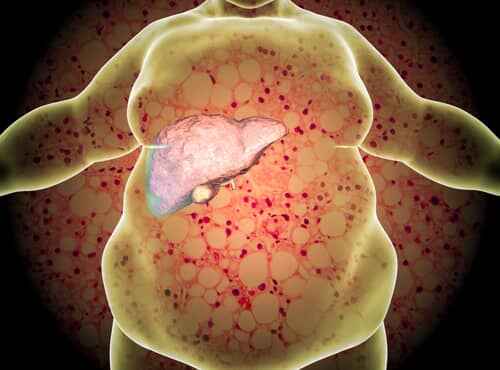 Ayurvedic Treatment For Fatty Liver