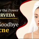 Acne Treatment in Ayurveda