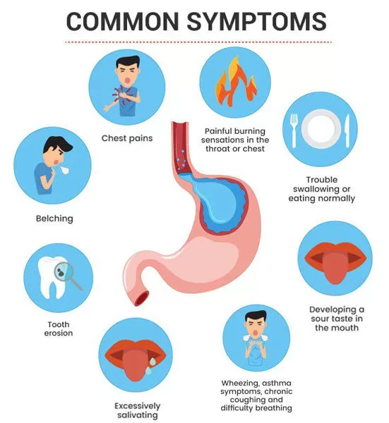 Symptoms of Acid Reflux