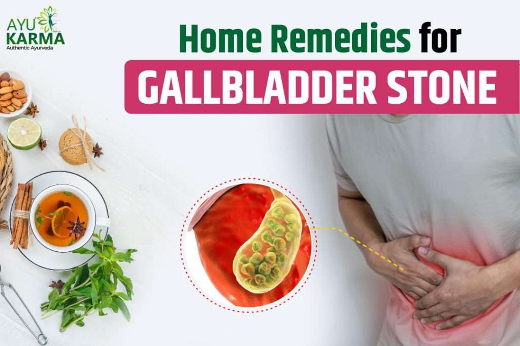 Home Remedies for Gallbladder Stone