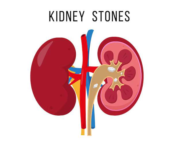 Kidney Infections Treatment with Ayurveda