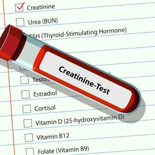 Symptoms of High Creatinine