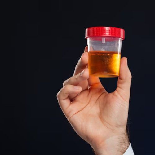 Dark or Infrequent Urine