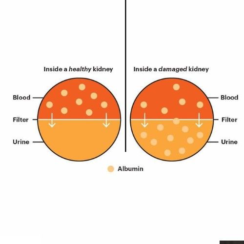 Albumin Trace