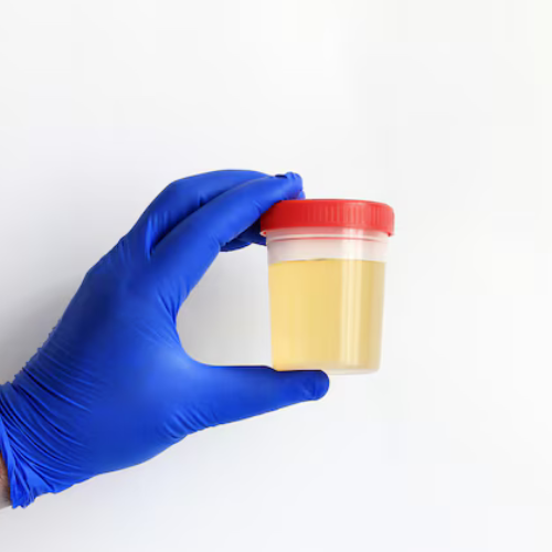 how to reduce protein in urine naturally