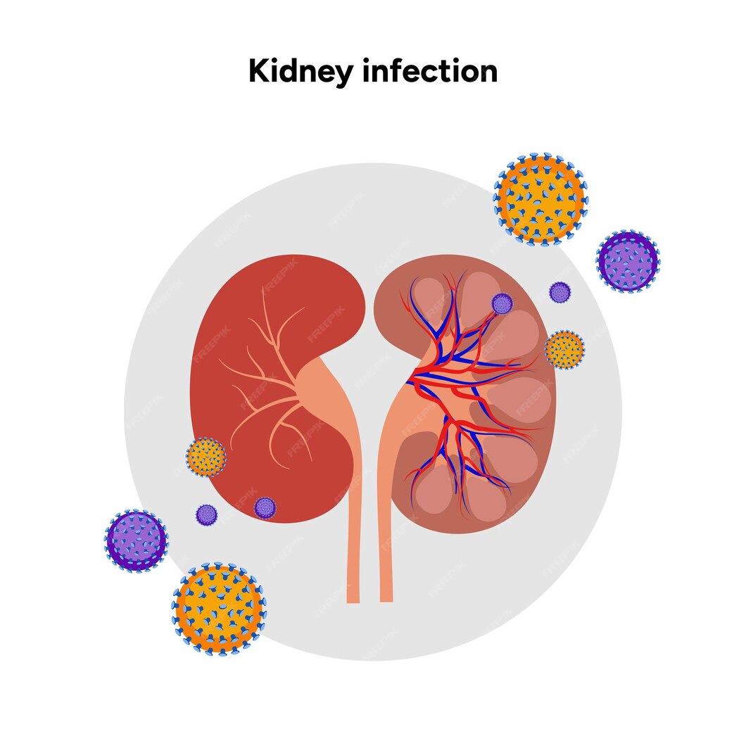 Natural Ayurvedic Treatment for Lupus Nephritis in the USA