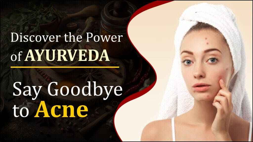 Discover the Power of Ayurveda: Say Goodbye to Acne