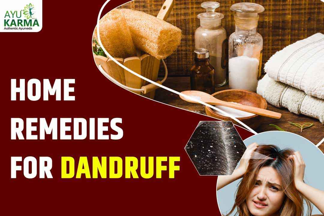 Home Remedies For Dandruff