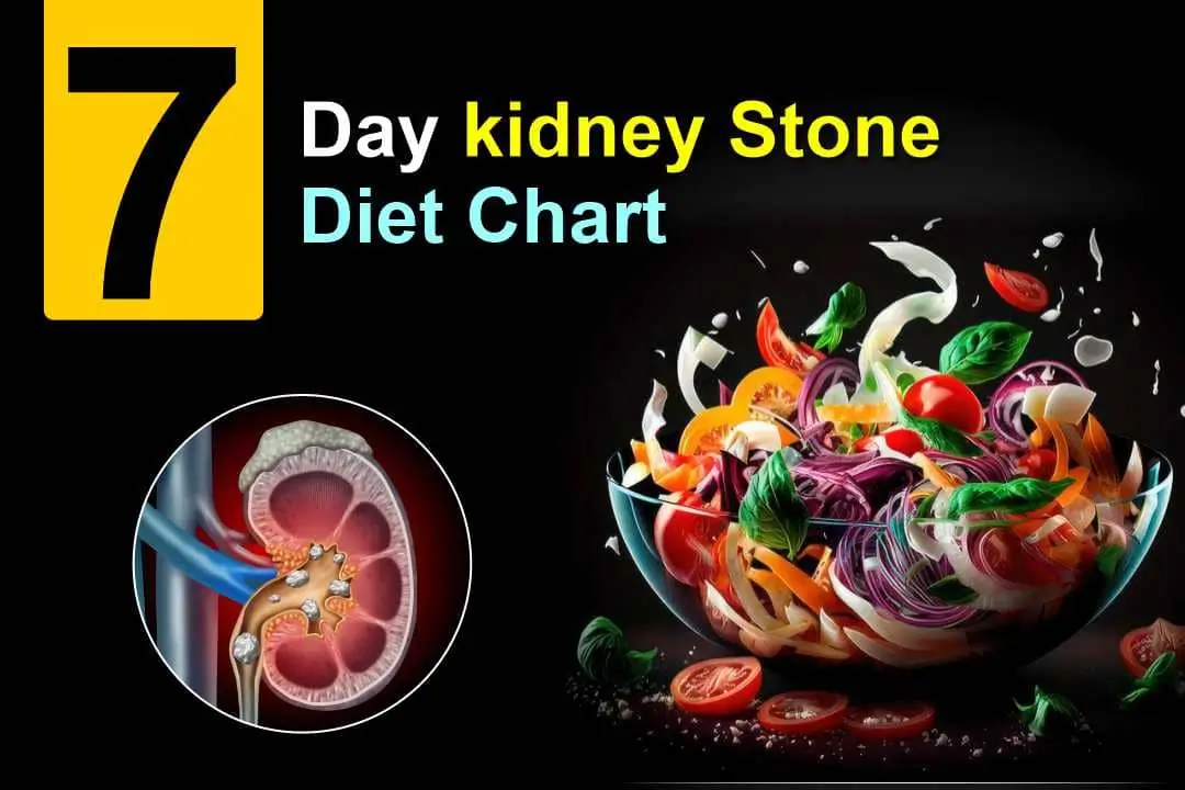 7 Day Kidney Stone Diet Chart