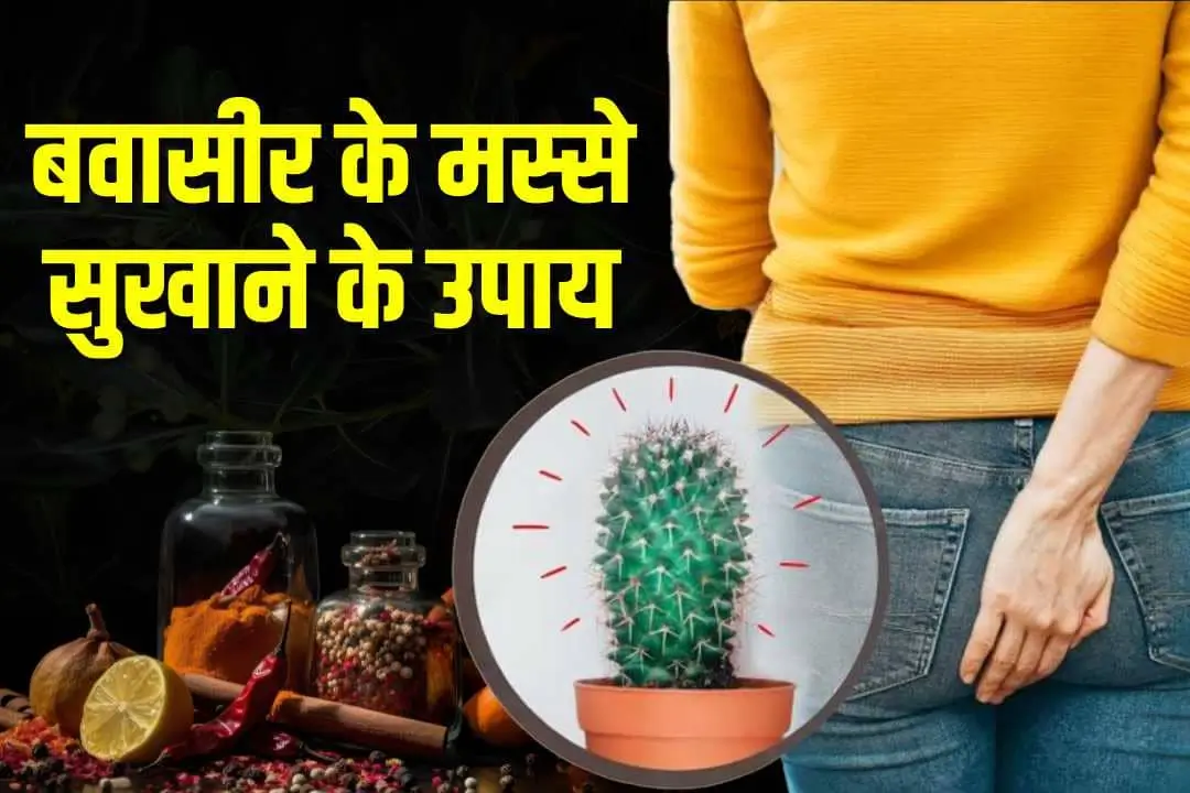 बवासीर के मस्से सुखाने के उपाय