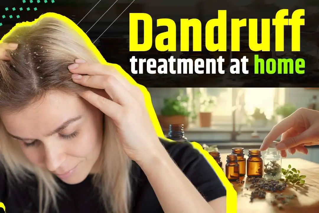 Dandruff Treatment at Home