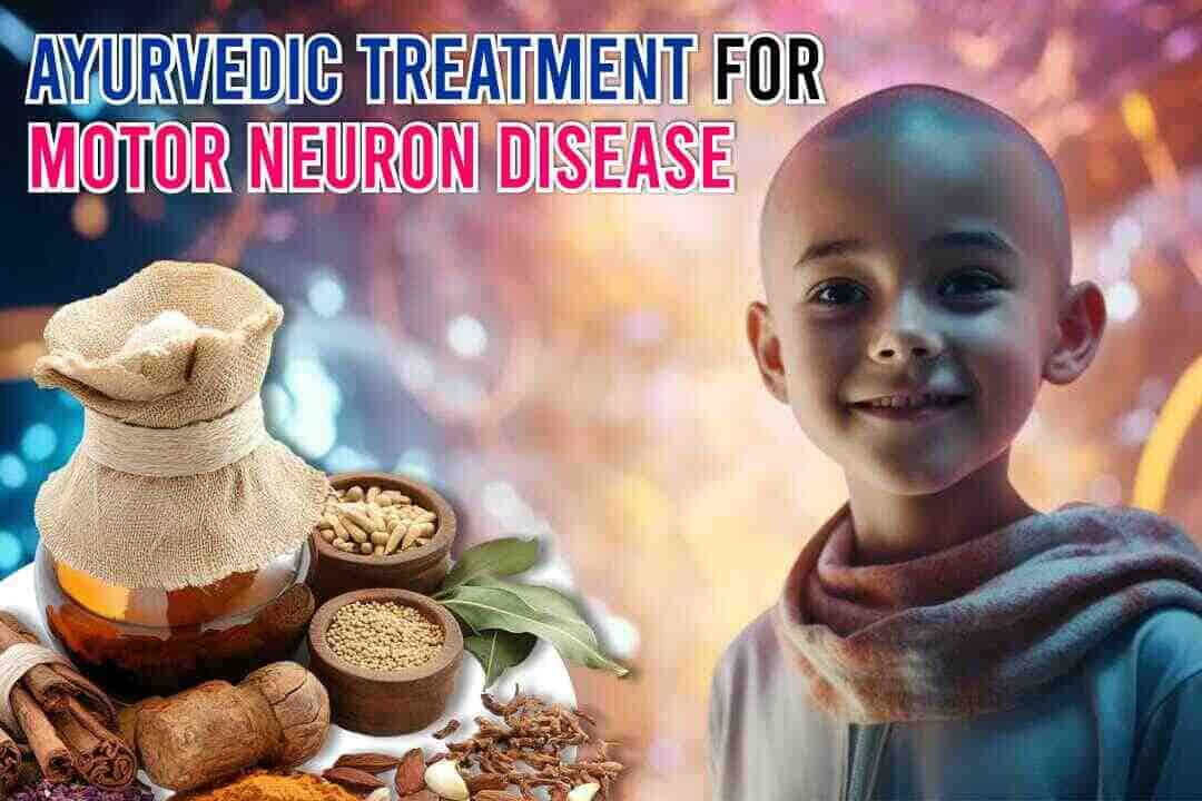 Ayurvedic Treatment For Motor Neuron Disease