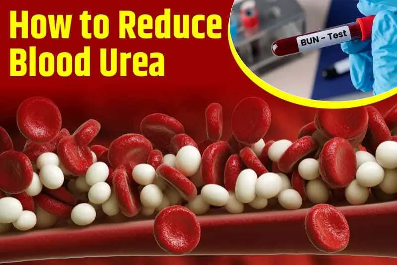 How To Reduce Blood Urea