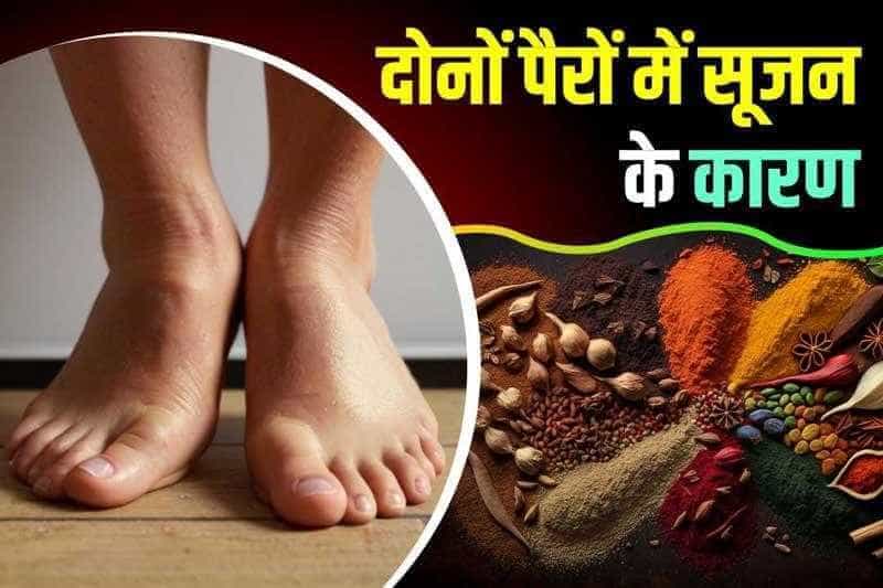दोनों पैरों में सूजन के कारण