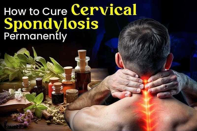 How To Cure Cervical Spondylosis Permanently