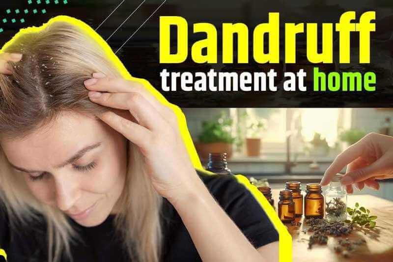 Dandruff Treatment at Home