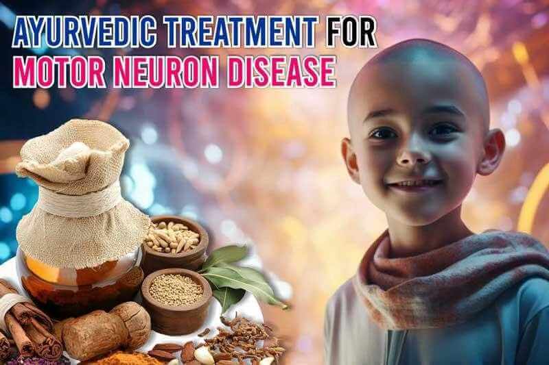 Ayurvedic Treatment For Motor Neuron Disease