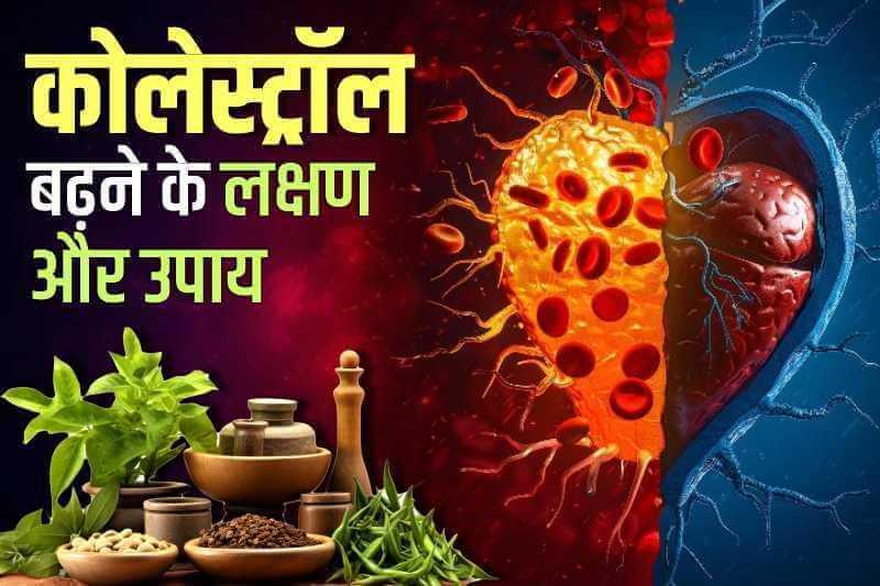 कोलेस्ट्रॉल बढ़ने के लक्षण और उपाय