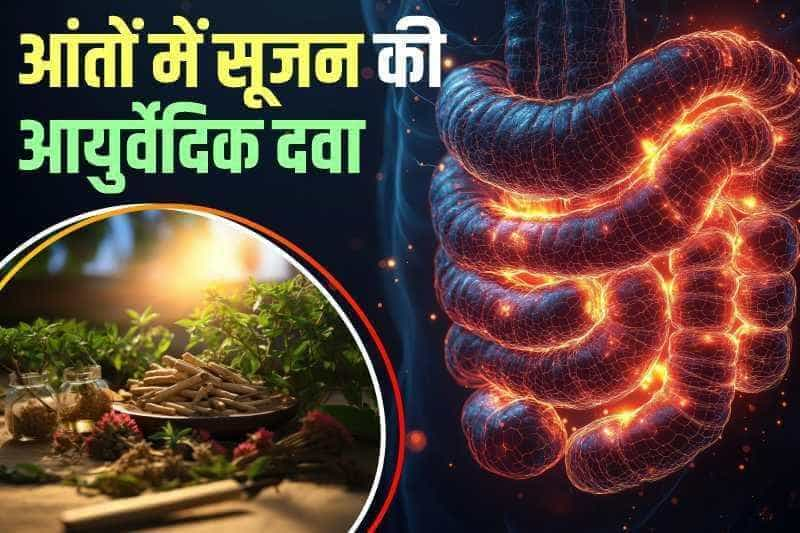 आंतों में सूजन की आयुर्वेदिक दवा