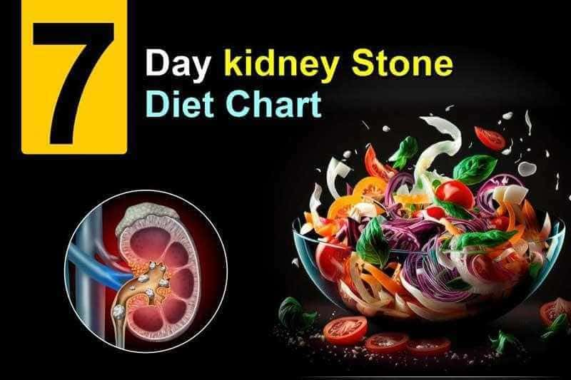 7 Day Kidney Stone Diet Chart