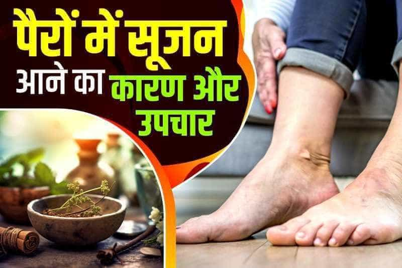 पैरों में सूजन आने का कारण और उपचार