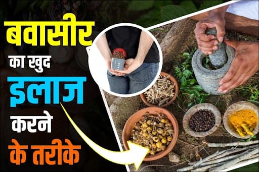 बवासीर का खुद इलाज करने के तरीके