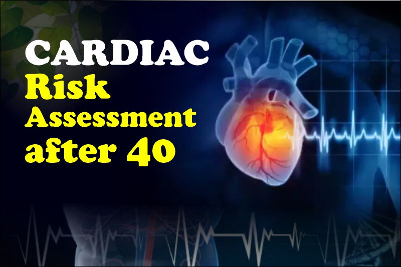 What Is the Cardiac Risk Assessment After 40