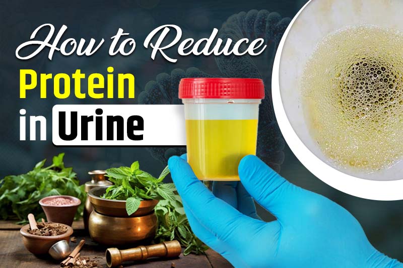 How to Reduce Protein in Urine