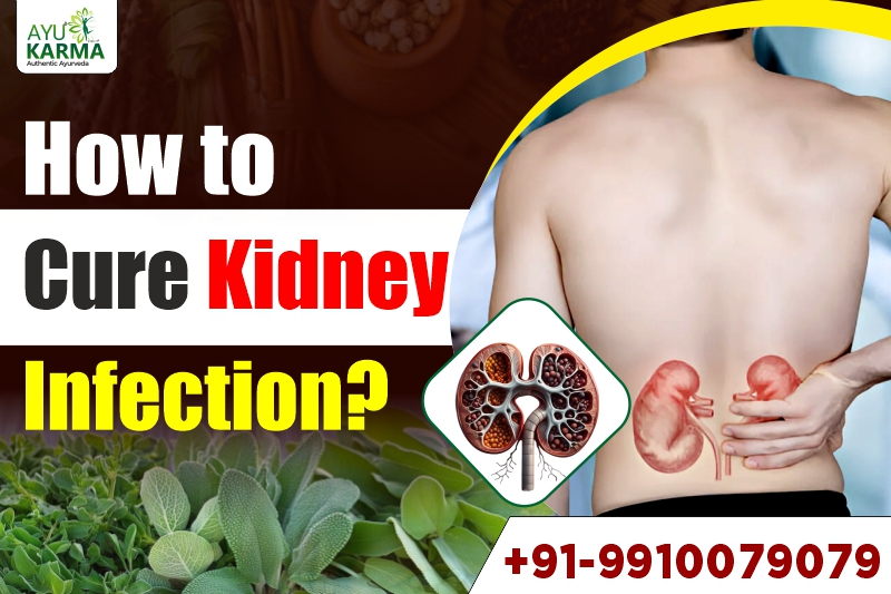 How to Cure Kidney Infection?