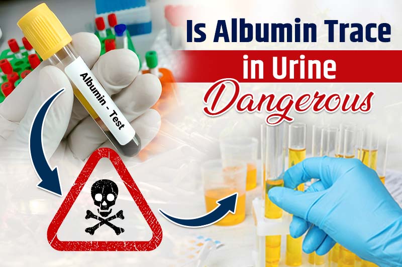 Is Albumin Trace in Urine Dangerous