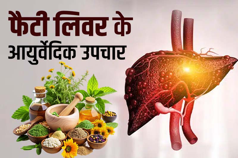 फैटी लिवर के आयुर्वेदिक उपचार 