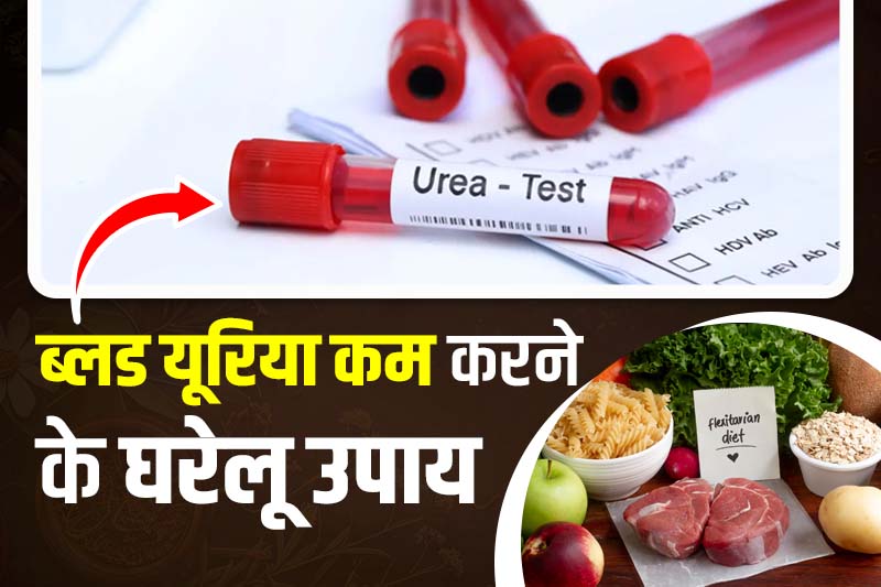 ब्लड यूरिया कम करने के घरेलू उपाय