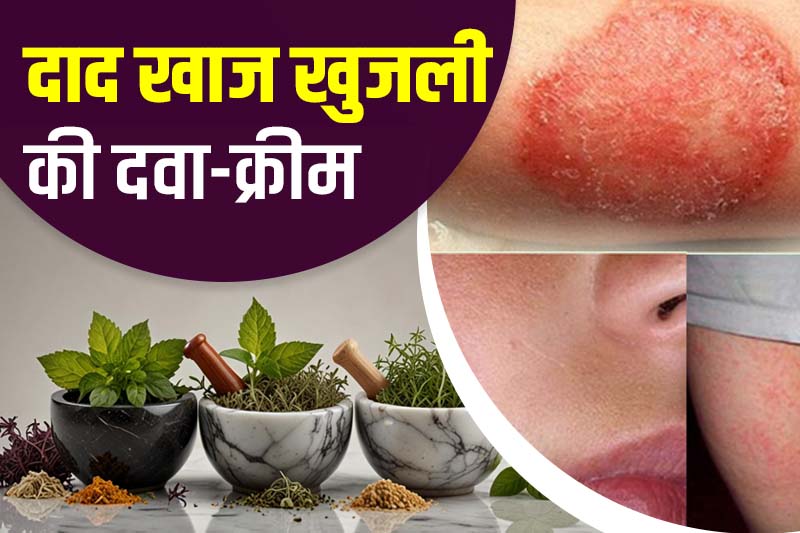 दाद खाज खुजली की दवा-क्रीम