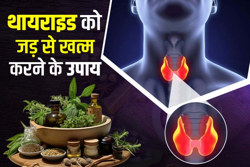 थायराइड को जड़ से खत्म करने के उपाय