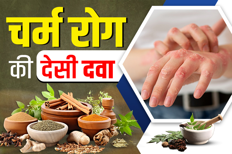 पुराना चर्म रोग का इलाज