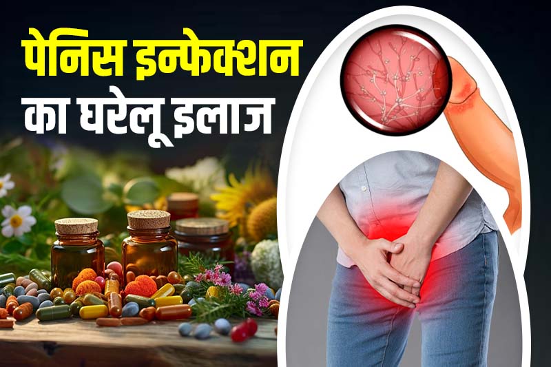 पेनिस इन्फेक्शन का घरेलू इलाज
