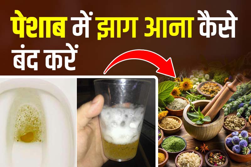पेशाब में झाग आना कैसे बंद करें