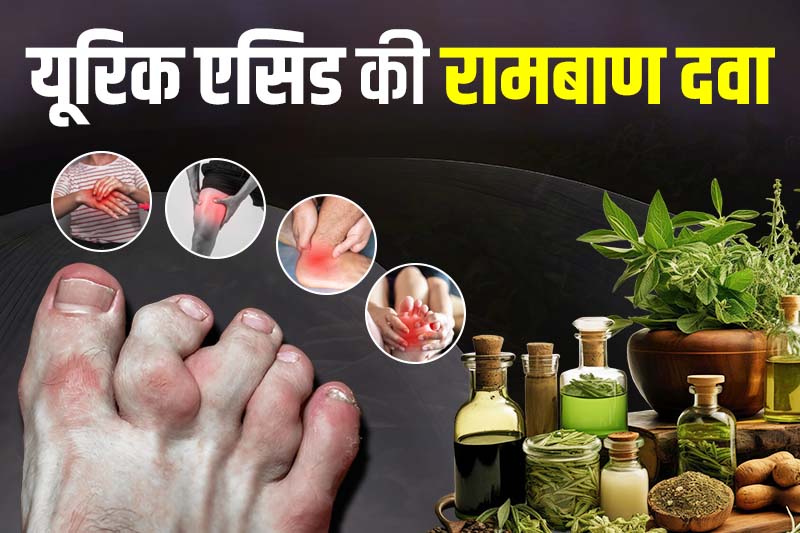 यूरिक एसिड की रामबाण दवा