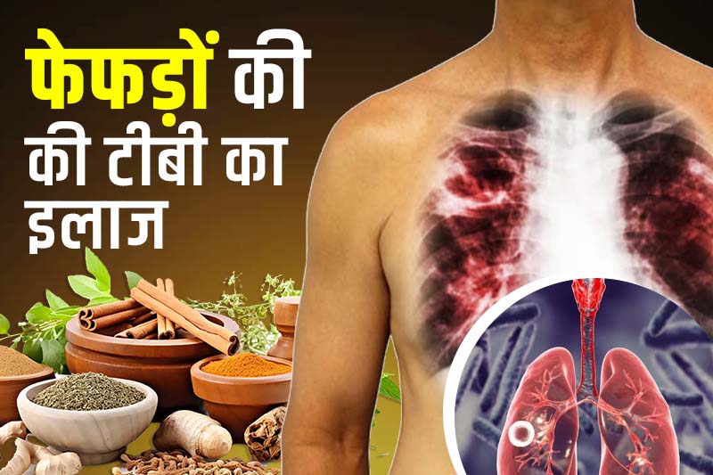फेफड़ों की टीबी का इलाज कितने दिन चलता है