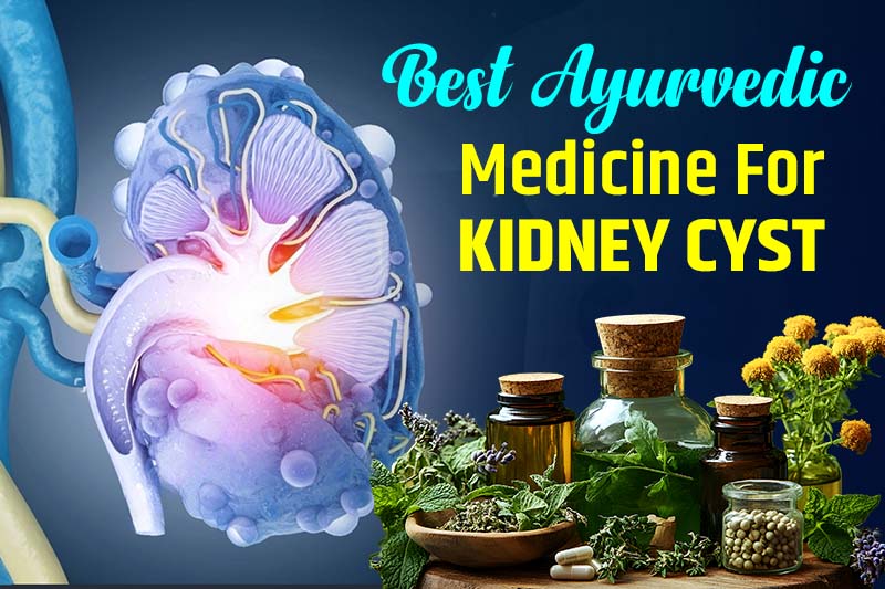 Best Ayurvedic Medicine for Kidney Cyst