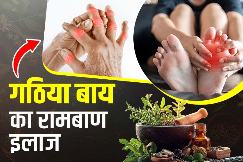 गठिया बाय का रामबाण इलाज