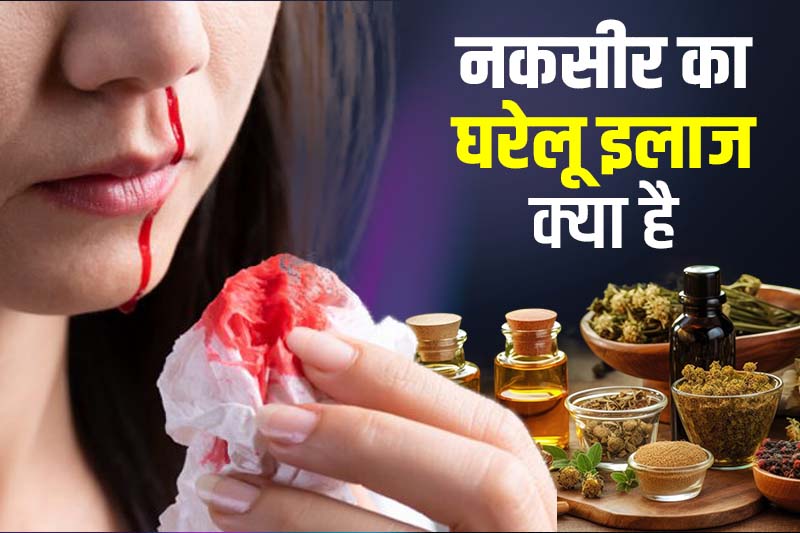 नकसीर का घरेलू इलाज क्या है