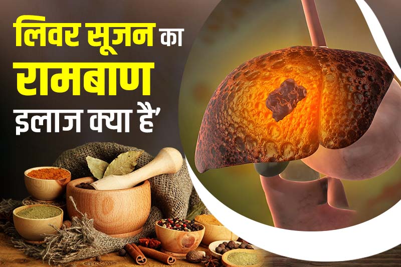 लिवर सूजन का रामबाण इलाज क्या है -  Liver Sujan ka Ramban Ilaj Kya Hai