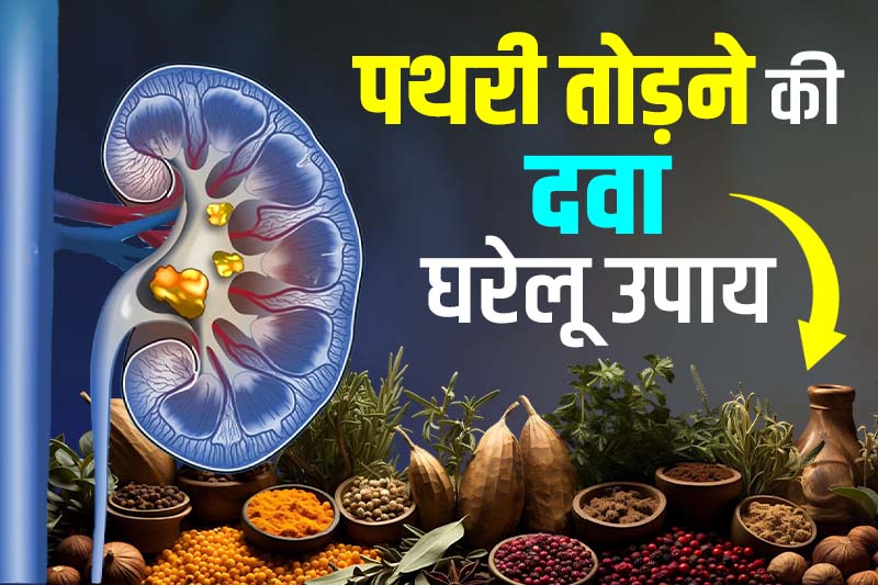 पथरी तोड़ने की दवा घरेलू उपाय Pathri ka ilaj