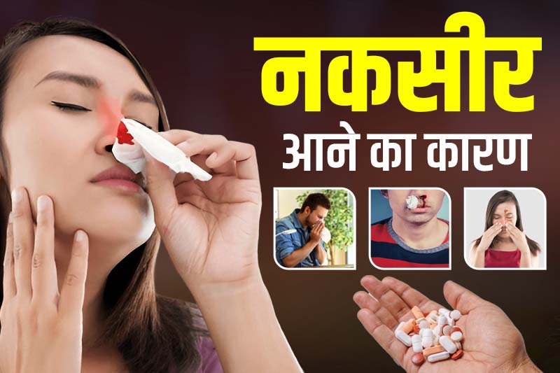 नकसीर आने का कारण