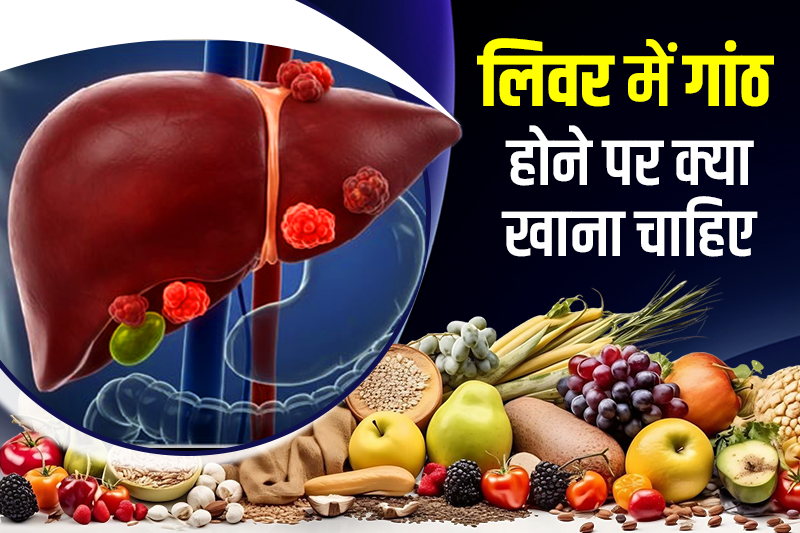 लिवर में गांठ होने पर क्या खाना चाहिए – Liver Mein Ganth  Hone Par Kya Khana Chahiye?