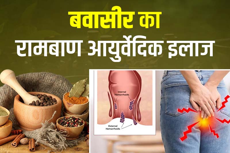 बवासीर का रामबाण आयुर्वेदिक इलाज