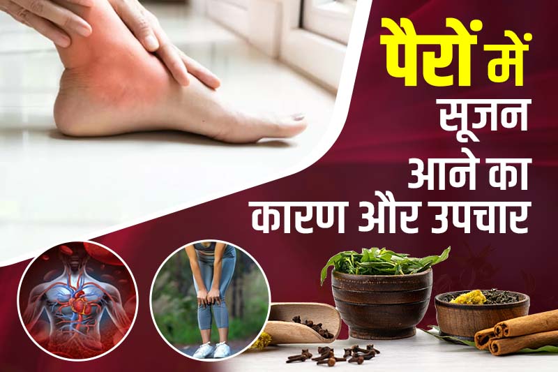 पैरों में सूजन आने का कारण और उपचार