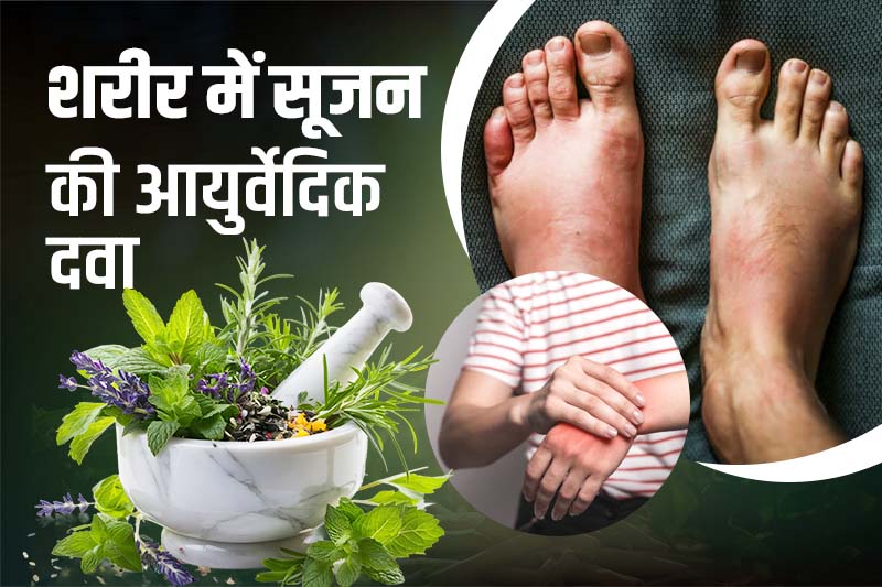 शरीर में सूजन की आयुर्वेदिक दवा